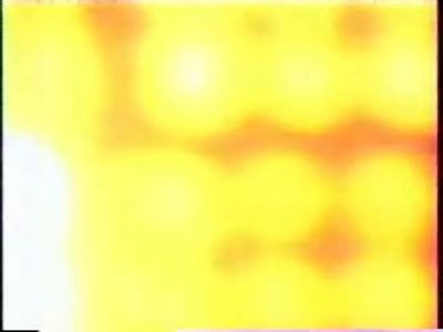General_Hospital_--_CarLo_Bumper001.jpg